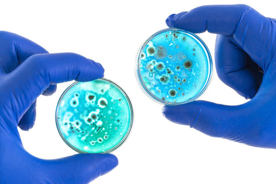 Hand In Blue Glove Holds Petri Dish With Agar And Bacterium Colony, Isolated