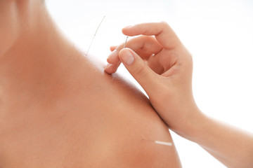 Young woman undergoing acupuncture treatment in salon, closeup - obrazy, fototapety, plakaty