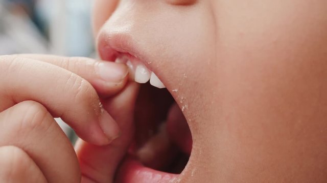 Close up of little girl is wiggle her milk tooth.