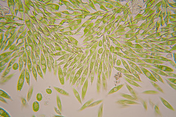 Tears viewed at the microscope. Magnification 100-1000x
