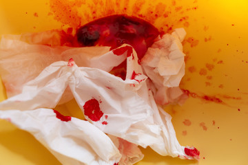 blood and bloody tissue in a bowl