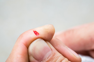 Man cut off his finger It’s bleeding and feel painful.
