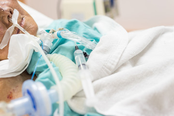 Patient do tracheostomy and ventilator in hospital