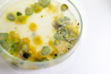 Backgrounds of Colony Characteristics of Fungus and algae in petri dish for education.