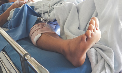 foot splint with iron on leg