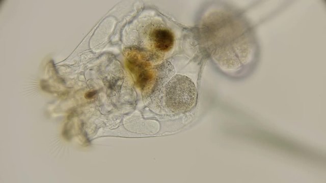 brachionus plicatilis rotifer, how it feeds and how microorganisms get into her stomach, a good example, under a microscope