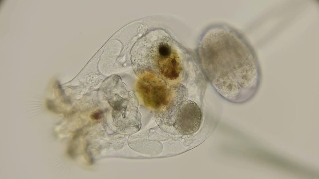 the rotifer Brachionus plicatilis with eggs, you can see all the internal organs and how they work, under the microscope