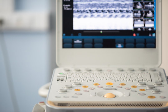 The control panel and the keyboard of the ultrasound device