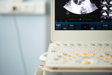 Image of a modern ultrasonic scanner with a keyboard and a monitor.