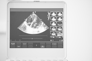 A monitor of a modern ultrasound scanner with a heart image in a four-chamber position. Black and white photo.