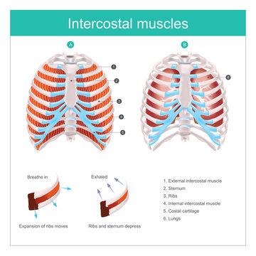 The thoracic cage is made up of bones and cartilage along, It consists of the 12 pairs of ribs with their costal cartilages and the sternum. 