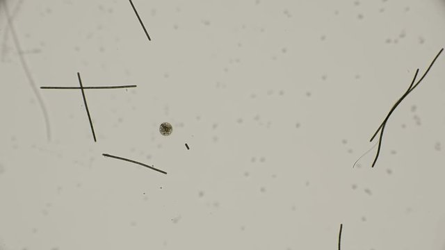 microorganism Heliozoa, Acanthocystis under the microscope