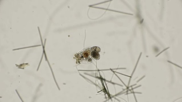 brachionus plicatilis rotifer, how it feeds and how microorganisms get into her stomach, a good example, under a microscope