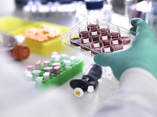 Cropped hand of scientist wearing protective glove holding multiwell tray containing stem cells during cancer research in laboratory