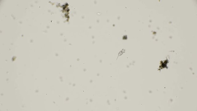 Squatinella mutica rotifer in motion, under the microscope