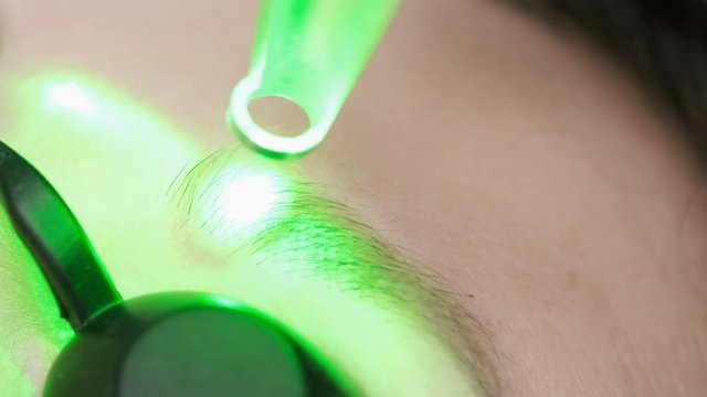 Woman undergoing laser removal of permanent makeup in salon. Eyebrow correction. Closeup female receiving correction of a tattoo on eyebrows procedure