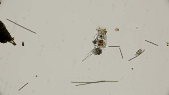 brachionus plicatilis rotifer, how it feeds and how microorganisms get into her stomach, a good example, under a microscope