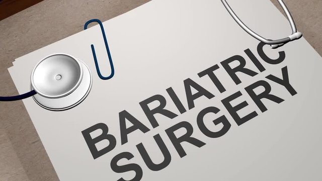 BARIATRIC SURGERY concept