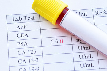 Abnormal high PSA test result with blood sample tube