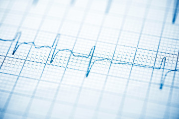 Electrocardiogram close up