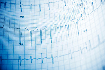 Electrocardiogram close up