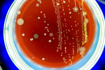 Petri dish with colonies of microbes