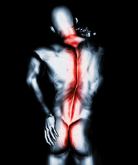 3D Illustration of sacral and cervical painful.