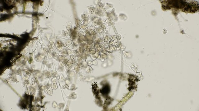 the colony of Vorticella and their movement when reduced, under a microscope