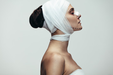 Female in bandage after plastic surgery on face