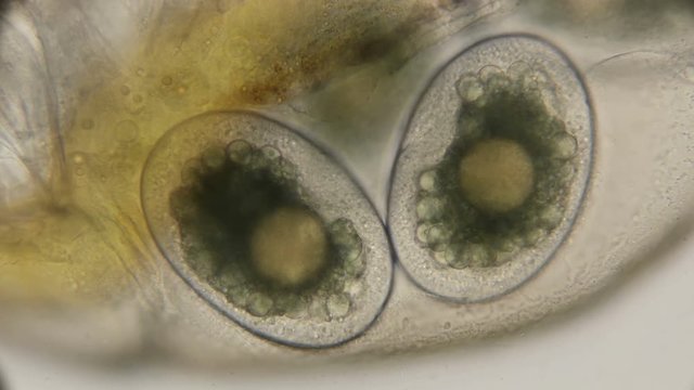 Daphnia eggs inside the body, under a microscope