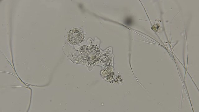 the amoeba parasite in motion, under a microscope