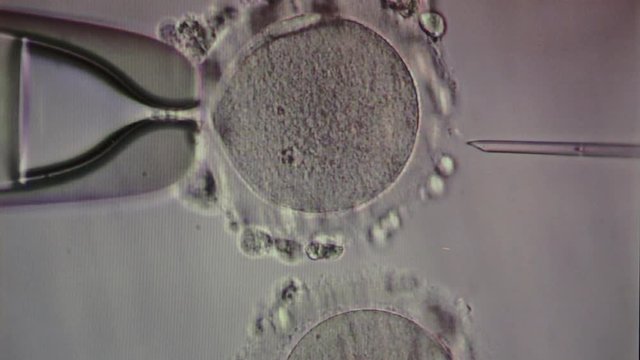 Оплодотворение под микроскопом видео Vídeos de In Vitro Fertilisation - Explore Vídeos HD do Stock de 405 Adobe Stock