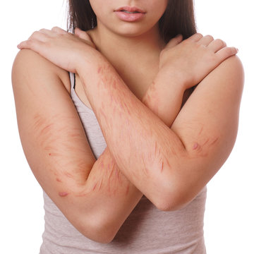 arms with scars and cuts from deliberate self-harm
