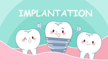 cute cartoon implant tooth