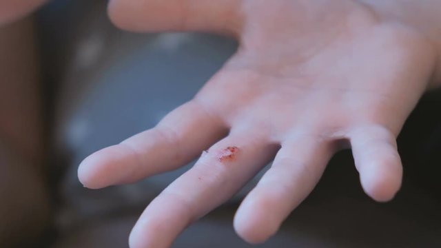 Mom puts a plaster on the wound on the finger of the child.