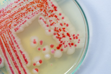 Serratia marcescens is a species of rod-shaped gram-negative bacteria in the family...