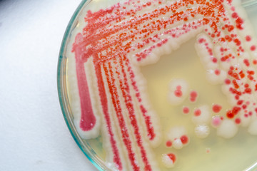 Serratia marcescens is a species of rod-shaped gram-negative bacteria in the family...