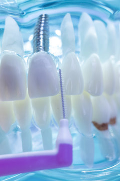 Interdental teeth clean brush