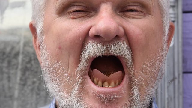 Crazy Russian elderly man with gray beard and mustache on purple and mirror background. Upper jaws fall from him in surprise.