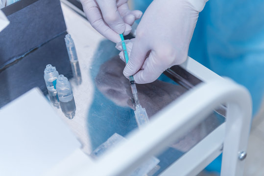 The hands of an anesthetist, who are taking medicine from the ampoule in a syringe. concept photo anesthesia, medicine without pain