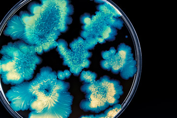 Macro photo of colorful wild growing bacteria and molds in a petri dish.
