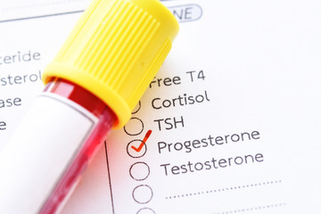 Blood sample tube with laboratory requisition form for progesterone hormone test 