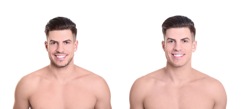 Handsome Young Man Before And After Shaving On White Background