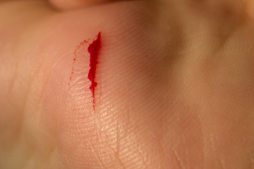 Hand of man injured wound from accident and blood bleeding on white background , insurance concept
