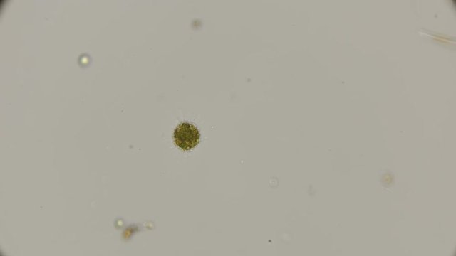 Acanthocystis, heliozoa under the microscope