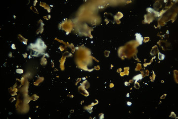 house dust in the microscope
