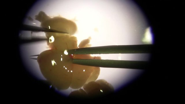researcher scientist microscope mouse brain dissection with forceps