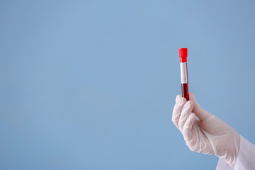 Lab worker holding test tube with blood sample on color background