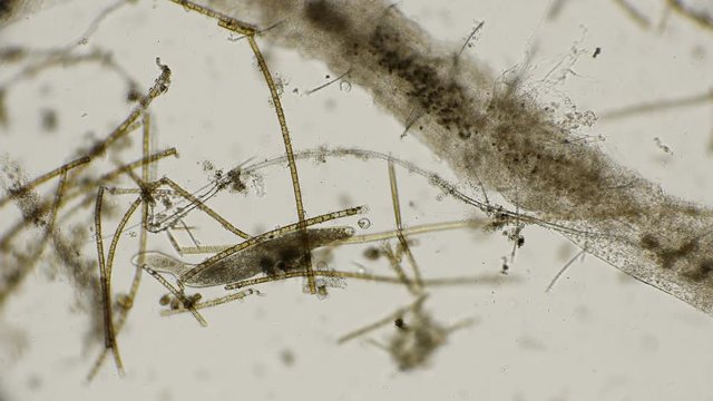 Flat ciliated worm Turbellaria under a microscope