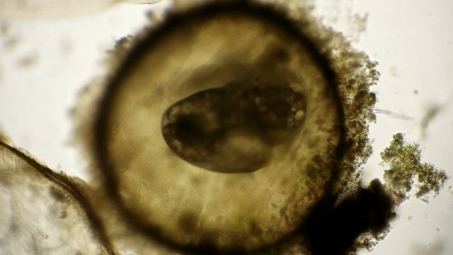 movement of the snail embryo in the egg, under a microscope
